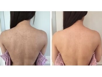 スリリアン 銀座/★お客さまビフォーアフター★