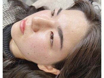 ニード 覚王山(NEED)/マツパ×HBL