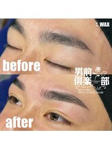 男前倶楽部/脱毛/メンズ脱毛/メンズ専門店
