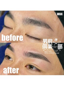 男前倶楽部/脱毛/メンズ脱毛/メンズ専門店