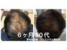 【経営者・営業職限定】第一印象格上げ！育毛促進鍼カウンセリング