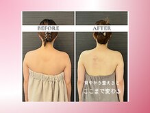 リスブランビューティー(Lys Blanc Beauty)/２週ペース４回の変化