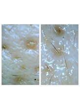 トランク(Trunk)/ハイドラ→エアバリ