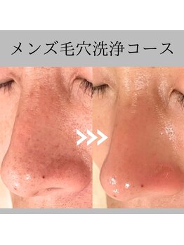 ニコ ウィズ(Nico with)/【メンズ】毛穴洗浄