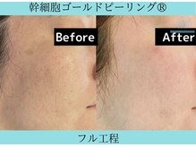 リメイククリニカルビューティー(Remake clinical beauty)/