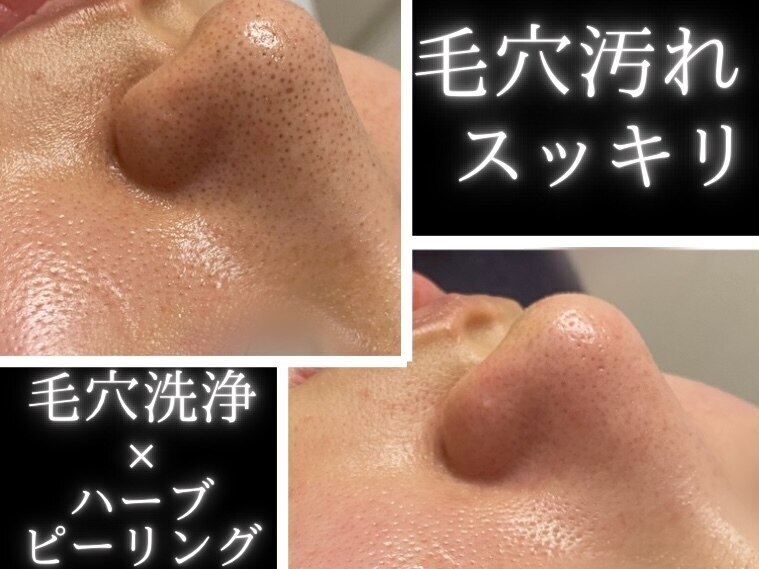 ホーミー(Homie)｜ホットペッパービューティー