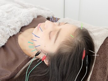 ルリア(Ruria)の写真/《女性専用/鍼灸＆美容鍼の同時施術が叶う！》リピート率80％以上の、結果にこだわりぬく鍼灸サロン登場！