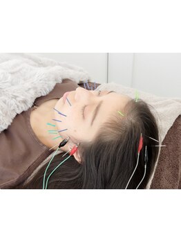 鍼灸施術を受けたい