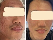 ナチュラルセラピー ドロップ(Drop)/男性でも通いやすいフェイシャル