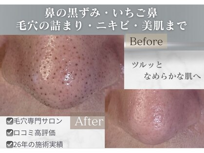 毛穴研究所の写真