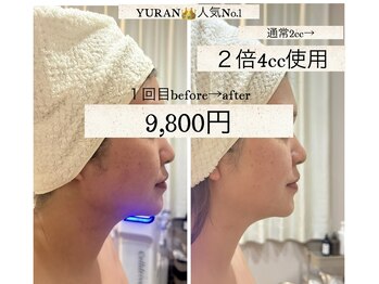 ユラン(YURAN)の写真/韓国で話題のレモンボトルを通常の2倍量【4cc】使用