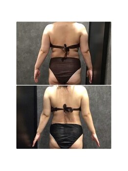 フローボディ 新山口店(flow BODY)の写真/1人ではなかなか頑張れない方もしっかりサポート★お客様のお身体や要望に合わせてコースをご提案します★