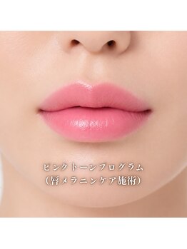フレイヤ(Freiya)の写真/☆ピンクトーンプログラム☆