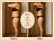 エメ(Aimer)の写真/【リピーター様90％以上】実力派最新ハイパーナイフEX２導入！×熟練ハンドでサイズダウン◎