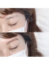 リヨン(LYON+831)/