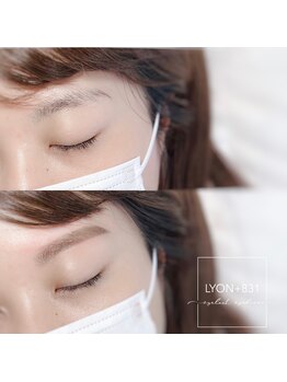 リヨン(LYON+831)/