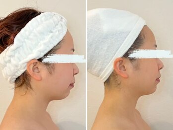 コルギ専門店 マキシフォート 栄店(Maxifort)/小顔コルギ体験レポート