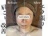 【劇的小顔☆】ハイパーナイフ小顔フェイシャル60min7.800円