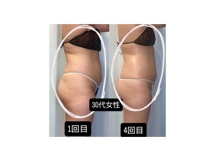 レチカ(Rechica)の写真