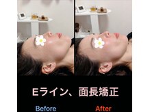 美容矯正サロン レレポノ(LELEPONO)/