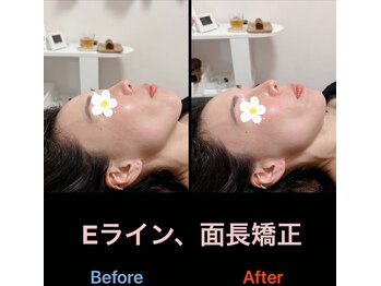 美容矯正サロン レレポノ(LELEPONO)/