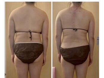 ココア(CoCoa)/活性リンパ洗浄