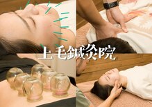 上毛鍼灸院