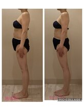 小顔コルギ専門店 フェルーシュ 成田駅前店(Feruche)/50代女性　結果写真