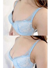 スマイルクルー(SmileClue)/ビフォーアフター症例