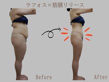 プレリー 自由が丘店/ラフォス/筋膜リリース