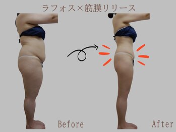 プレリー 自由が丘店/ラフォス/筋膜リリース