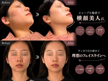 クアダ 天神(QUADA)/ 痩身/腰痛/骨盤矯正