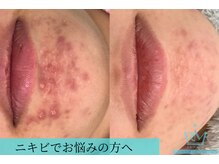 リメイクビューティークリニック(REMAKE BEAUTY CLINIC)/諦めないでほしい