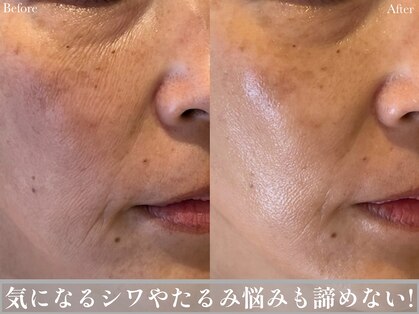 マボーテ 恵比寿(Ma-Beaute)の写真