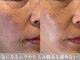 マボーテ 恵比寿(Ma-Beaute)の写真