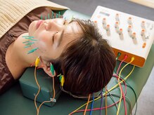 キート美容鍼灸 整体院(Kiito美容鍼灸 整体院)/美容鍼３