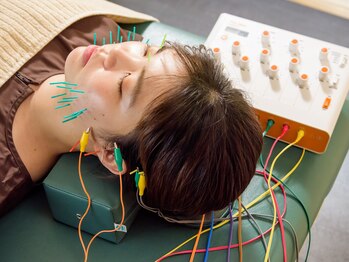 キート美容鍼灸 整体院(Kiito美容鍼灸 整体院)/美容鍼３