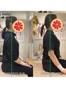 グレフル鍼灸接骨院 整体院 心斎橋/整体/肩こり/マッサージ/腰痛