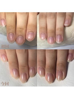 ティヤム(TIAM)/自爪育成ネイル☆