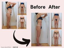 ミネルバエンダモロジー/エンダモロジー/痩身/ウェルネス