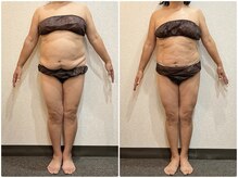 美容整体ウェリナ あま甚目寺院/小顔矯正/骨盤矯正/美脚サロン