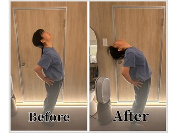 整体ラルース 中目黒(LALUZ)/40代 女性 猫背、巻き肩改善