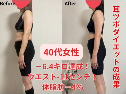 ア クイーユの写真