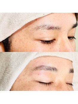 FRONTの写真/【メンズ美容デビューを応援】男性スタッフによるマンツーマン施術で、お悩みも気軽に相談しやすい♪