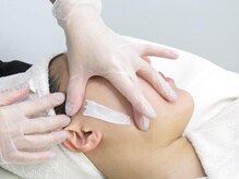 ルノン(LUNON)/WAX脱毛フェイシャル