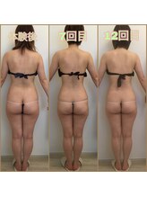 シュシュ(Chou chou)/泉佐野エステ　シュシュ　結果