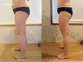 エステティックサロン エスぺランス(ESPERANCE)/脚もスッキリ美脚へ