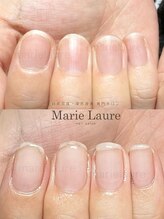 マリーロール 淀屋橋本店(Marie Laure)/自爪育成/深爪矯正/ネイルケア