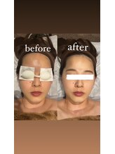 さつき整骨院/光フェイシャル