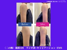 フェレザ 新潟(Felleza)/筋肉は破断と修復を繰り返す